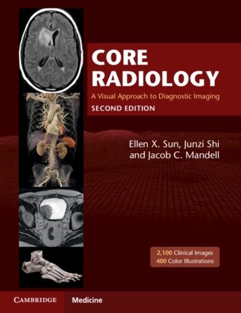 CORE RADIOLOGY : A VISUAL APPROACH TO DIAGNOSTIC IMAGING | 9781108965910 | ELLEN X. SUN, JUNZI SHI, JACOB C. MANDELL