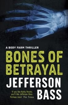 BONES OF BETRAYAL | 9781847249814 | JEFFERSON BASS